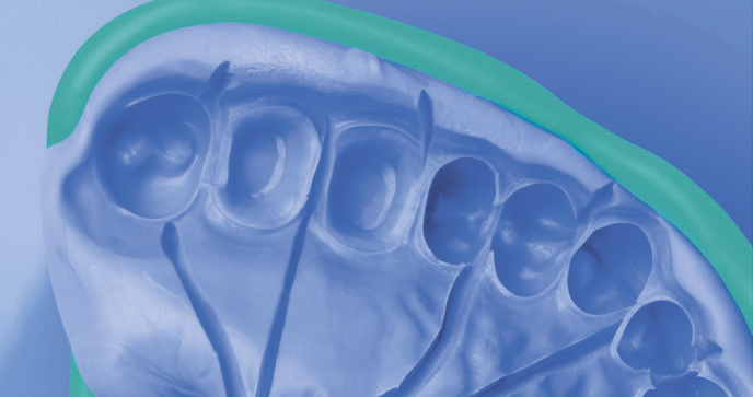 Силагум Патти Софт с дренажными каналами